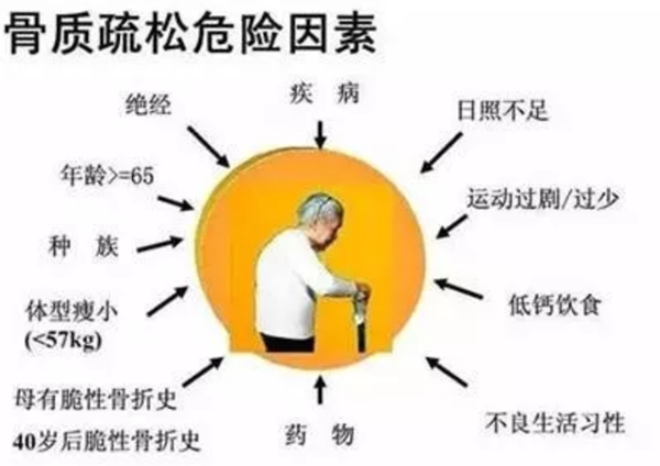通过骨密度仪了解到，骨质疏松比想象的还严重